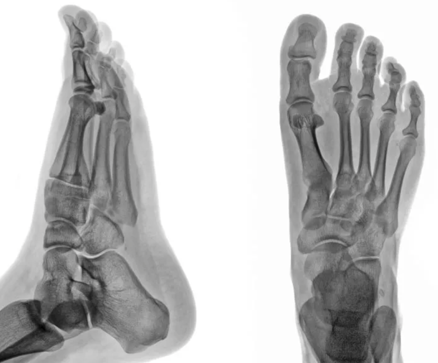 foot_scan.png
